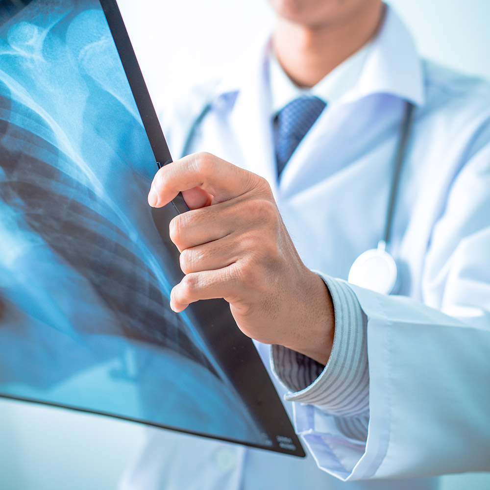 Doctor holding an X-ray
