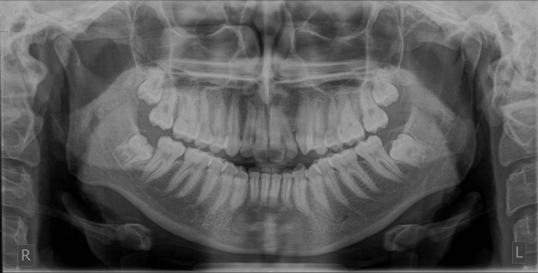 Specialist Dental Reporting